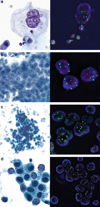 Fluorescence In Situ Hybridization (FISH) - BioVantra, LLC